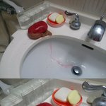 우리집 화장실에서 적출된 장기가....??