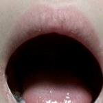 나는 입 크게벌리면 <b>윗니</b> 안보여