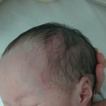 신생아 중환자실.