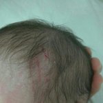 춘천 강*병원을 고발합니다.