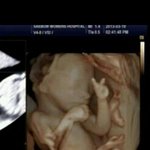 어머어머ㅋㅋㅋ  요녀석좀<b>보소</b>ㅎ