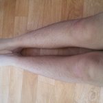 (사진)여자 다리털 최강인사람 여깃다