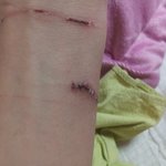 아프다 니가 그럴수록...