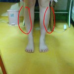 <b>사진o</b>)저종아리는뺄수없는건가요??