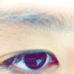 <b>눈밑</b>에 뭔가요