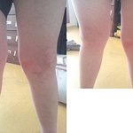 장애아동 활동보조인의 학대 정말 진실이 무엇인지 궁금합니다!!!