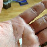 <b>냉동</b>교자만두에서 플라스틱 파편이 나왔습니다