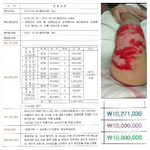 13개월 아기 식당 화상+덧글+목격자 덧글 추가