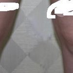 <b>예시</b> <b>사진</b>有) 최악의 코끼리다리.아톰다리.다리살을 어떻게 빼야할까요...