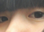 쌍수해야될까요?ㅠㅠ