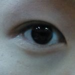 한쪽에만 쌍커<b>풀이</b>있는 심한 짝눈이에요....해결책좀 ㅠㅠㅠㅠㅠ