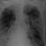 사람죽이는 도립<b>안동</b>의료원 엉터리 의사와 직무유기하는 원장은 즉각...