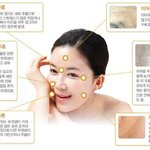 한방성형을 하려고 하는데... 정말 <b>주름</b> 말끔히 없앨수 있겠죠?