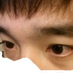 (사진)심한 다크<b>서클</b> 지우는 법 아시는분?