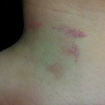 5년 넘게 만난 애인놈 바람나서 임신한 상태로 차였습니다.