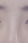 사진유 코수술한것같은<b>모양</b>인데