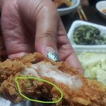 (사진 有)머리카락까지 같이 튀겨온 네x<b>치킨</b>