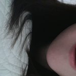 <b>앞이빨</b>이 짝짝이에요ㅠ