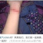 exo <b>중국팬</b> 자해한거 기사뜸(사진있음 혐오주의)