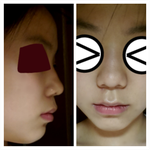 제 <b>코</b> 어때요? 사진 유