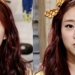 한승연 턱 <b>성형</b>