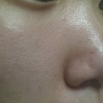 ㄱㅏ사해요)이게어딜봐서16살짜리피부일까요,,
