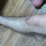 반바지 입어야하는데 털때문에고민..어떤지좀봐주세요 <b>톡님</b>들
