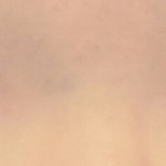 제 눈 <b>사시</b>인가요?