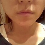 <b>넙대</b>대한 얼굴이 나름 갸름해진 것같죠?;;;;