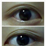 <b>겹쌍</b>커풀때문에 고민입니다 ㅠㅠ