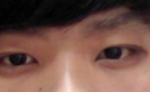다크<b>써클</b>이 너무심합니다 ㅠㅠ (사진잇어요)