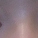 有 <b>쌍액</b> 전후차이가 너무 심해요....쌍수 해야할까요??