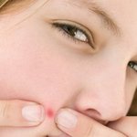 <b>왕</b> <b>여드름</b> 때문에 피부가 뒤집어졋....