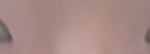 쌍커<b>풀</b> 다 풀린 건가요?