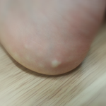 이게뭔가요..<b>판님</b>들도와주세요ㅠㅠ