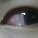 (혐짤)눈이<b>충혈</b>