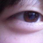 쌍커풀수술하는게 더 낫나요