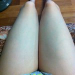 허벅지 눌림좀 봐주세요