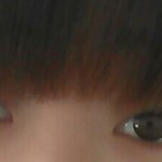 저 쌍꺼풀<b>수술</b> 해야할까요?(수정)