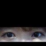눈 이상한가요