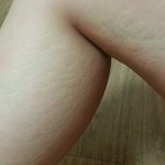 혐) 다리 좀 봐주세요ㅜㅜ반바지가 입고 싶어요