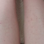 혐오주의)사진ㅇㅇ)언니들내다리어<b>캐</b>ㅠㅠ