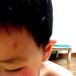 저희아들이야기 입니다 !! 어린이집 <b>원아</b>폭행 서명운동합니다 !!...