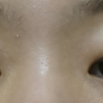 언니들 <b>동생</b>들 제 <b>눈</b>좀 봐주세요ㅠㅠ
