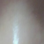 중3인데 쌍수조언좀요