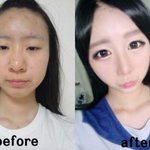네이트 <b>영자</b> 불쌍해서  글남겨연..