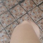 제 <b>손목</b>에 혹같은게 있어요