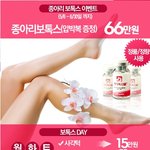 종아리 보톡스 후기올립니다.