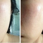 부<b>스팅</b> 에센스 추천! 독소제거 에센스 꽃초세럼을 소개해요