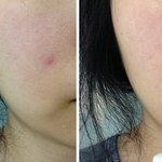 피부의 독소 빼주는 독소제거 에센스~ 부<b>스팅</b> 에센스 추천!